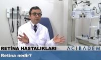 retina-nedir