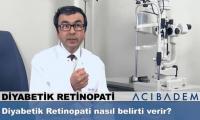 diyabetik-retinopati-nasil-belirti-verir