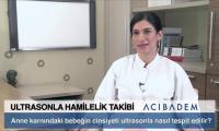 anne-karnindaki-bebegin-cinsiyeti-ultrasonla-nasil-tespit-edilir