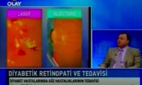 diyabetik-retinopati-tedavisi-hakkinda-bilgi-izle-video